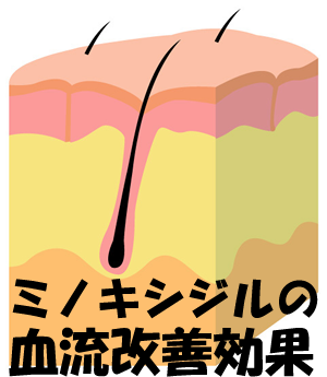 ~mLVW̌P